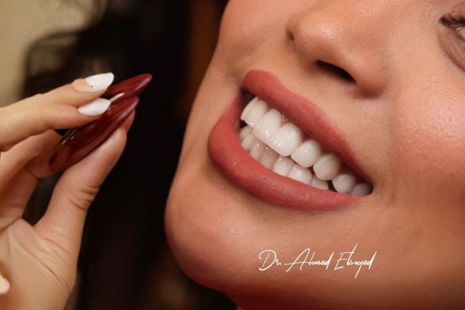 Hollywood Smile in Dubai